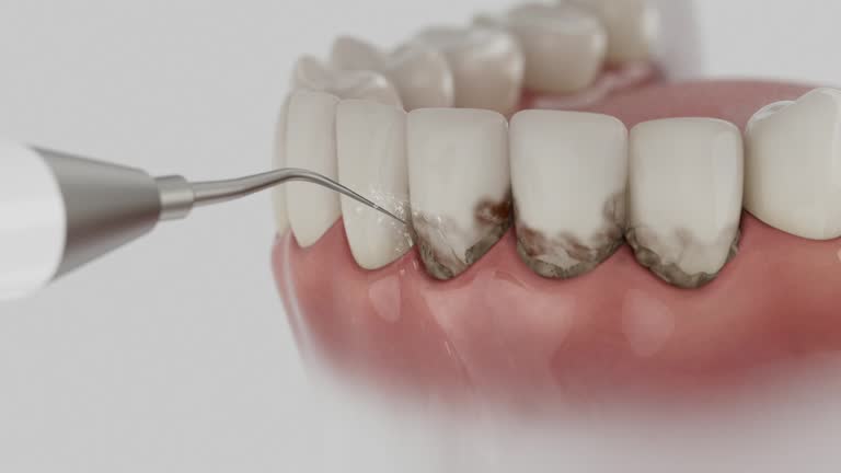 Reliable Dental Implants contractor in Matamoras, PA by Smile Center Dentistry